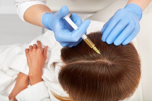 prp-hair-restoration-patient